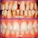 BeeRenew Advanced Gum Healing