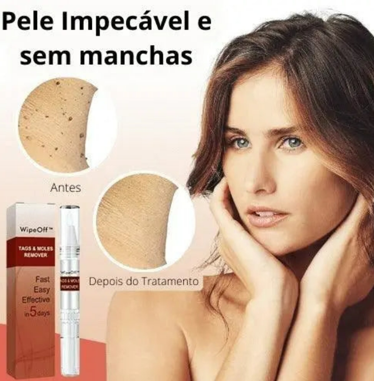 ЕХТЕRМIΝАDОR DЕ VERRUGAS E PINTAS  - ENTREGA EXPRESSA