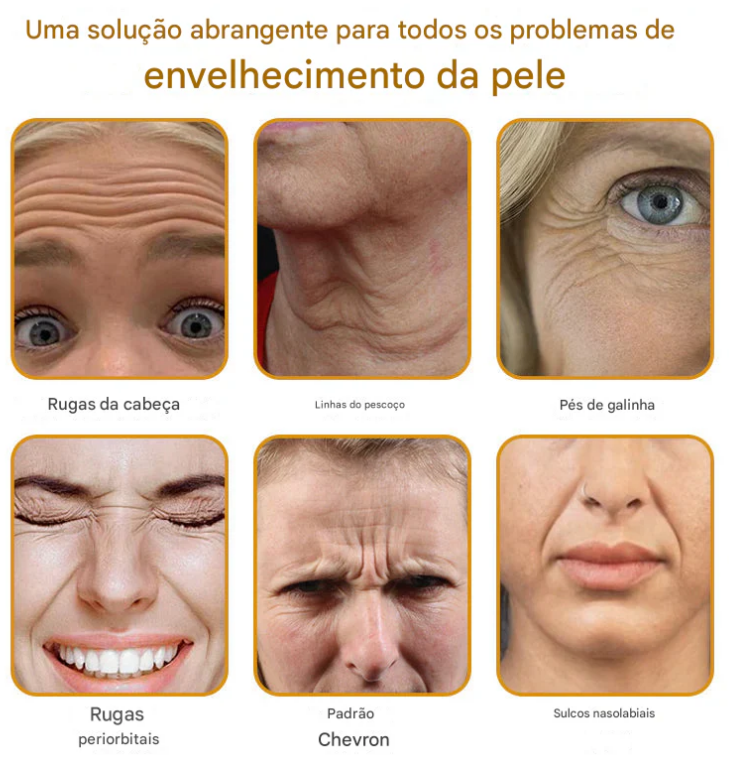 Creme removedor de rugas Botox Bee Venom - 🐝 Promoção relâmpago: só hoje!