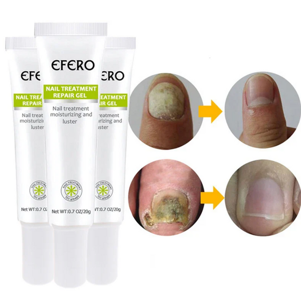 Gel Antifungo Efero