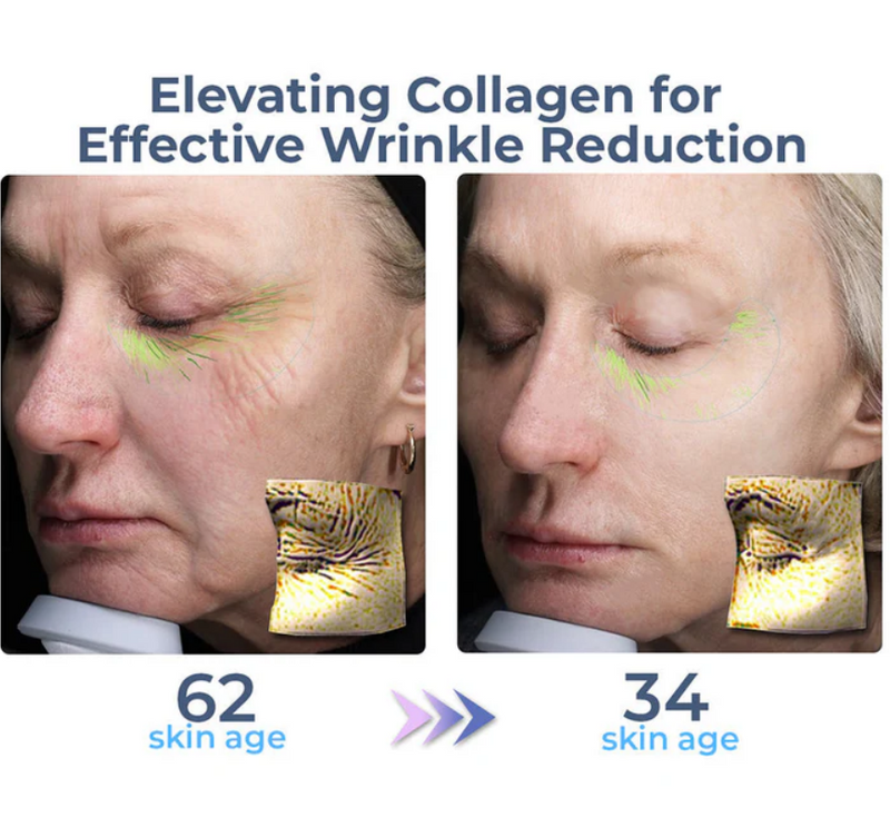 Creme avançado para os olhos com colágeno completo