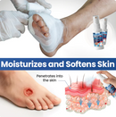 Spray GlucoDerm