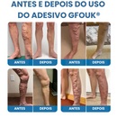 VEINTARGET - O FIM DAS VARIZES