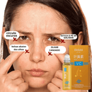  Luteina GLOW Rolon 5 em 1 ultra  - Rejuvenescedor
