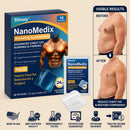 Adesivo NANOMEDIX® para Ginecomastia, Queima de Gordura e Firmeza do Peito